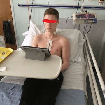 Post-surgery